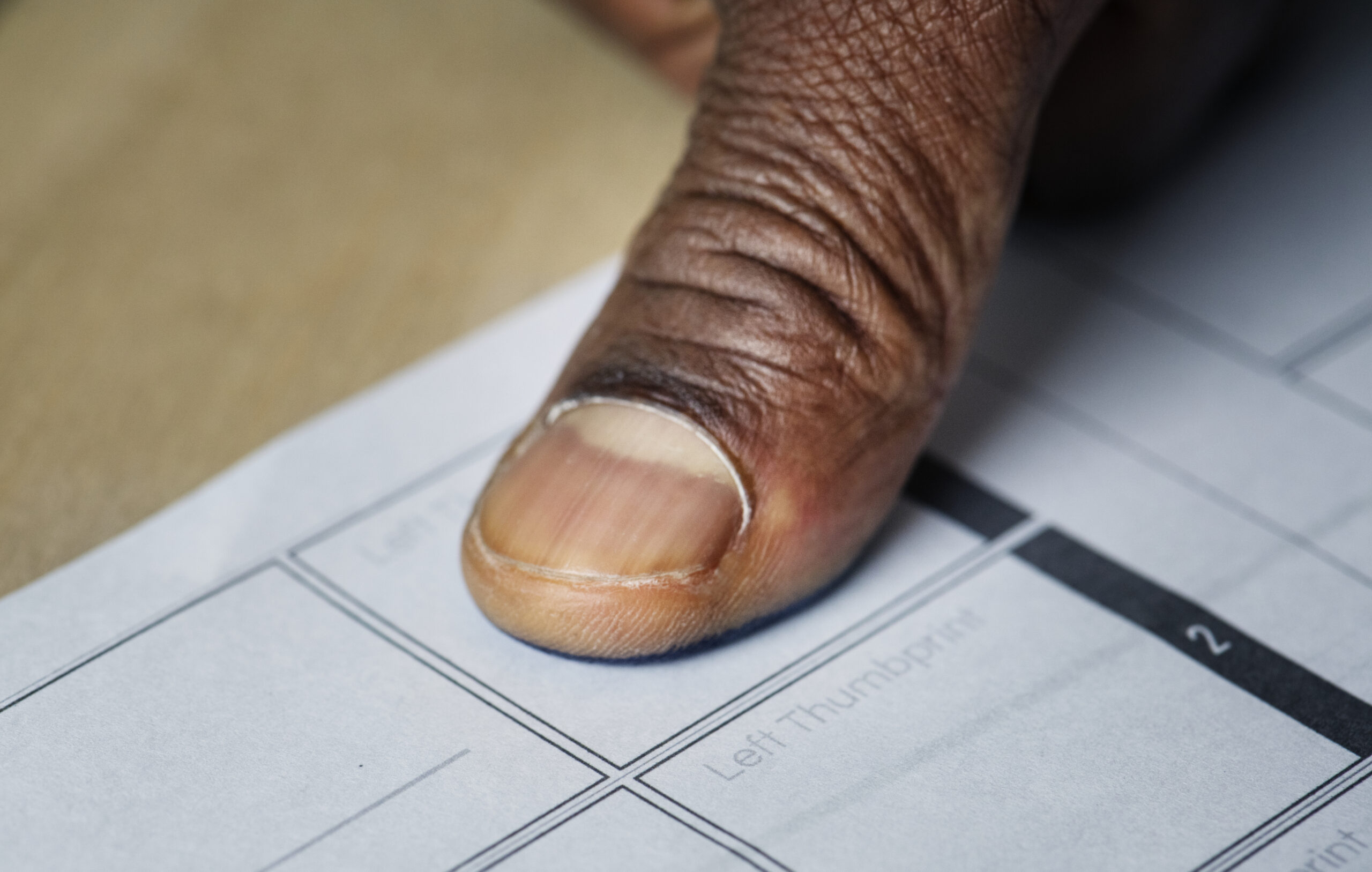 Empowering Citizens: Somalia’s Official Information Bill Should Align with Global Standards for Effective Governance